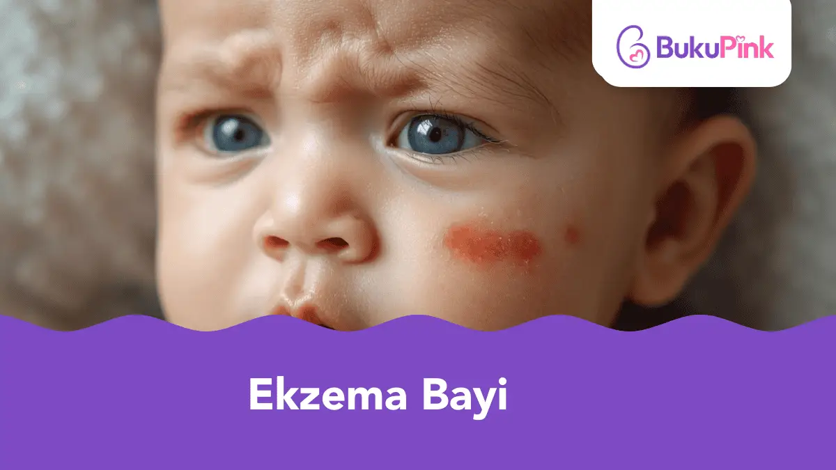 ekzema bayi