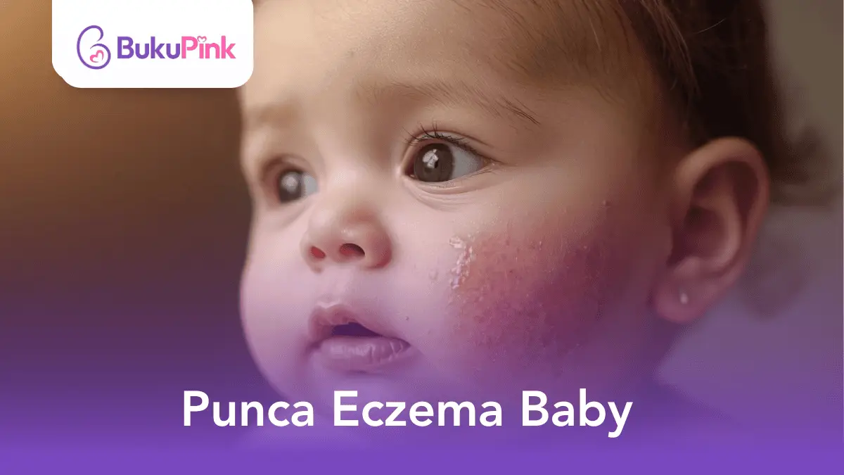 punca eczema baby