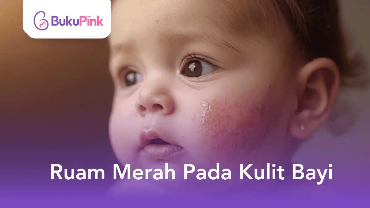 ruam merah pada kulit bayi