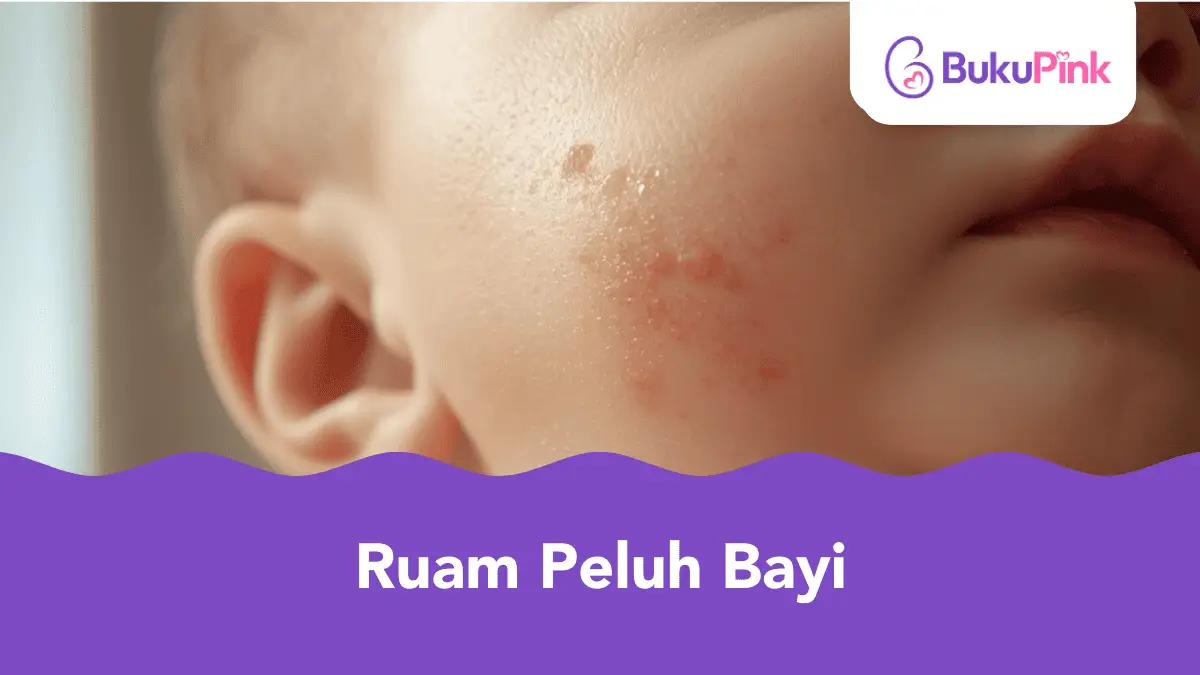 ruam peluh bayi